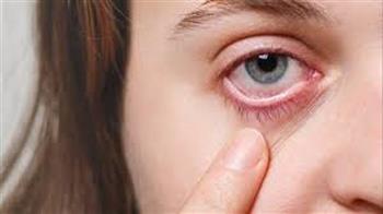 ما سبب إصابة العيون بالجفاف في فصل الشتاء؟ الصحة تجيب