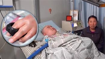 معجزة حقيقية.. صيني مصاب بالشلل يدير مزرعة ذكية بإصبع واحد