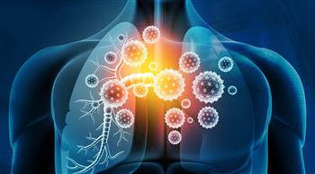 أعراض التهاب الشعب الهوائية