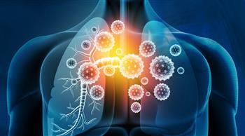 أعراض التهاب الشعب الهوائية