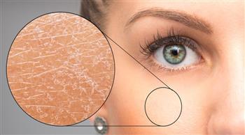 في الشتاء لحماية الجلد من الجفاف والتشققات ...اتبع الآتي