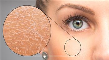 في الشتاء لحماية الجلد من الجفاف والتشققات ...اتبع الآتي