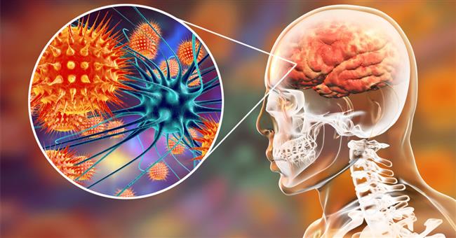 انتبه..تلك هى طرق الإصابة بالحمى الشوكية