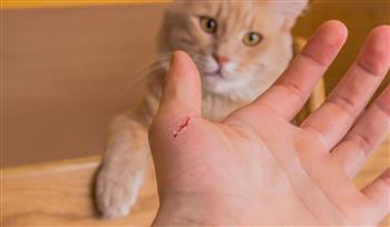 ما هو مرض "خدش القطة"؟