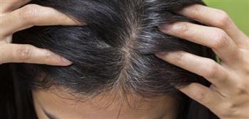 وداعا للشيب المبكر.. إليك حلول طبيعية بعيدا عن الصبغات