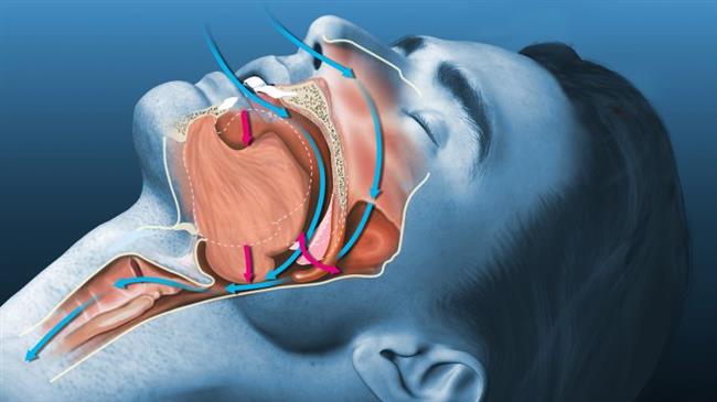 انتبه الجفاف وراء الاصابة بالشخير