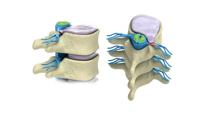 نصائح لحماية العمود الفقري