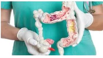 أعراض مبكرة لسرطان القولون