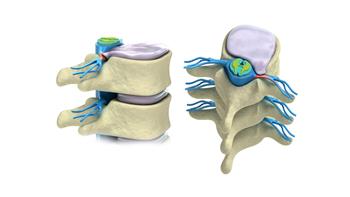 نصائح لحماية العمود الفقري