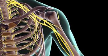 التهاب الضفيرة العضدية السبب وراء ألم الذراعين