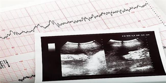 ماذا تعرف عن تأخر نمو الجنين داخل الرحم