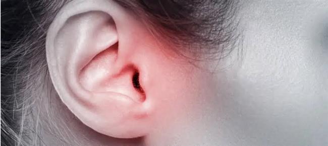 تعرف على أنواع التهاب الأذن الوسطى