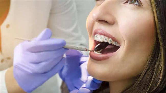 العلاقة بين ضعف الأسنان وهشاشة العظام