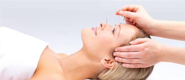 أمراض يمكن علاجها بالإبر الصينية..فماهى؟
