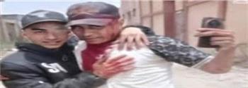 ضبط عاطلين تعدوا علي شخص بسلاح أبيض والتقطا معه سيلفي غارقاً بالدماء