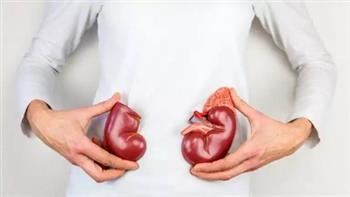عادات تدمر الكلى .. أهمها الإفراط في البروتين الحيواني 