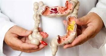 أعراض الإصابة بزوائد القولون