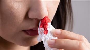 خلال الصيف ..كيف تقي نفسك من نزيف الأنف؟