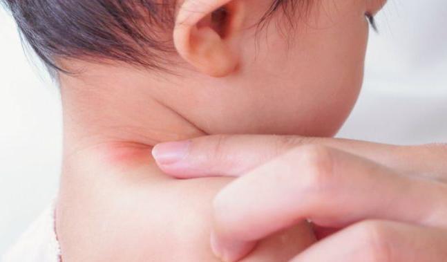 للأمهات.. أسباب التواء رقبة طفلك وطرق فعالة لعلاجه