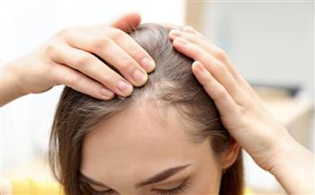 نصائح للوقاية من مرض الثعلبة
