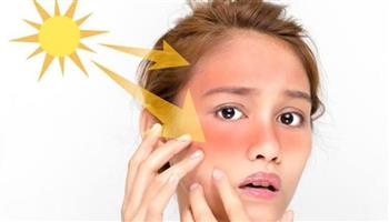 تسلخات الجلد ..لماذا تظهر فى المصيف؟