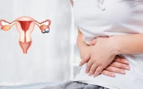 إنقاص الوزن ضرورة لعلاج تكيس المبايض