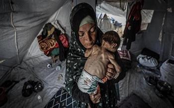 وزارة الصحة بغزة: 5 شهداء بسبب المجاعة وسوء التغذية بينهم طفلان خلال 24 ساعة