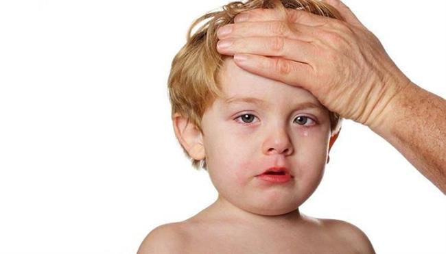 تعرف على أهم أسباب الإصابة بالحمى الشوكية
