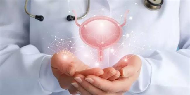 طرق علاج التهاب المثانة ..تعرف عليها 