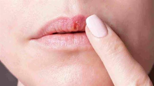 تغيرات بسيطة في الشفاه تنبهك لمشاكل صحية لا تتوقعينها