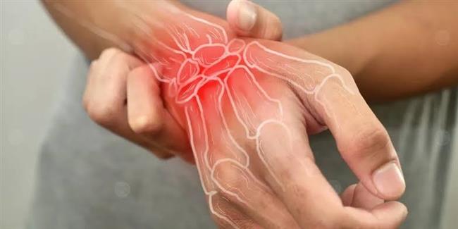 أهم الأعراض لإلتهاب المفاصل
