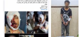 ضبط المتهم بالتعدي على شخص بسلاح أبيض وإصابته بالإسكندرية