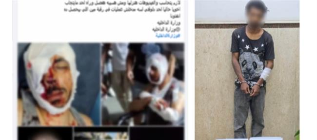 ضبط المتهم بالتعدي على شخص بسلاح أبيض وإصابته بالإسكندرية