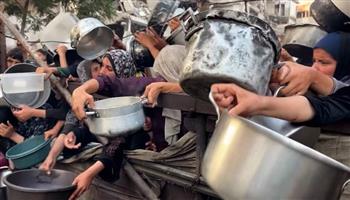وزارة الصحة بغزة: ارتفاع عدد ضحايا المجاعة وسوء التغذية إلى 303 شهداء من بينهم 117 طفلا
