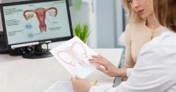 السمنة ..سبب رئيسي لتكيس المبايض