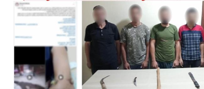   ضبط طرفي مشاجرة الأسلحة البيضاء في البحيرة