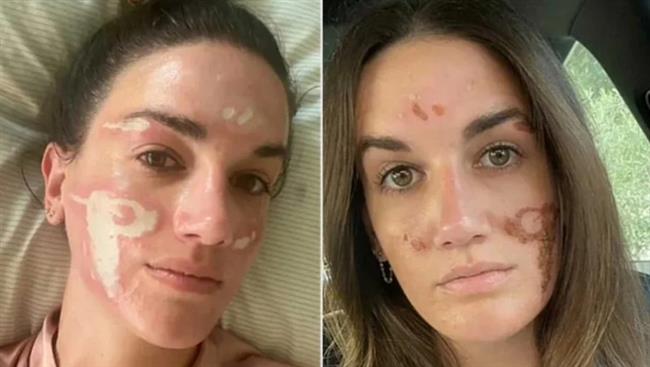 خبيرة تجميل شهيرة تشوه وجه فتاة مقابل 90  ألف دولار