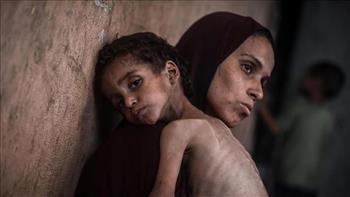 صحة غزة: 4 وفيات نتيجة المجاعة وسوء التغذية بينهم طفل خلال الساعات الـ24 الماضية
