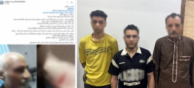 خلافات الجيرة وراء تعدي 3 أشخاص على مسن في الدقهلية 