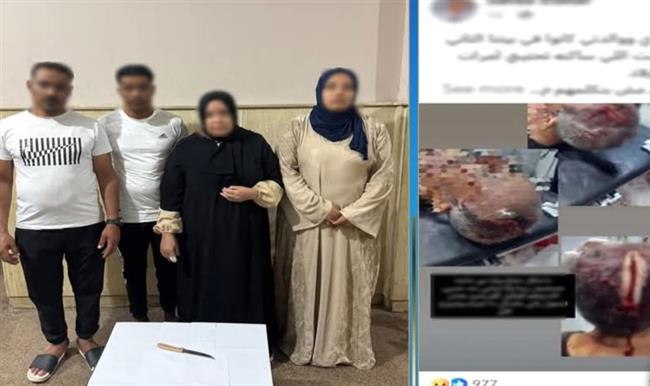 خلافات عائلية وراء إصابة شخص بجرح قطعي في الرأس بكفرالشيخ