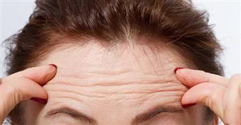 تعرفي علي أسباب تجاعيد الجبهة