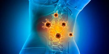 التهاب العمود الفقري سببًا رئيسًا لآلام الظهر