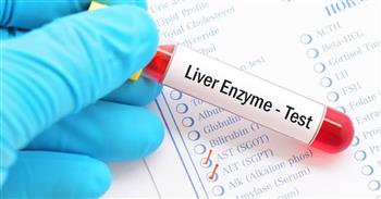 أعراض ارتفاع إنزيمات الكبد لمريض السكر