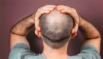 اكتشف أنه أصلع.. هندية تقدّم شكوى رسمية غريبة ضد زوجها