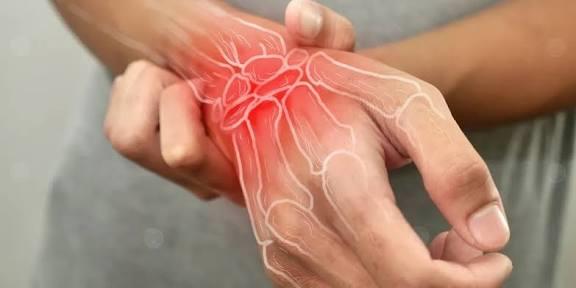 مؤشرات خاصة بإلتهاب المفاصل..اكتشفها