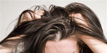 وصفات طبيعية لفروة الرأس الملتهبة