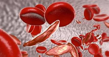 تعرف على أنواع الأنيميا