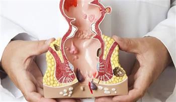 أعـراض النـاسـور الشـرجي