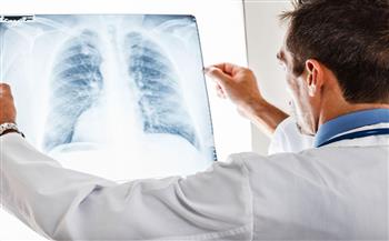 ما هي أعراض "الوذمة الرئوية"؟