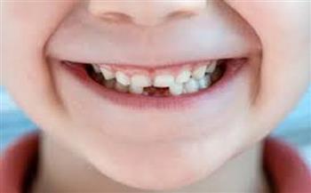 الصحة: 4 عادات سيئة يجب تجنبها للحفاظ على صحة أسنان طفلك